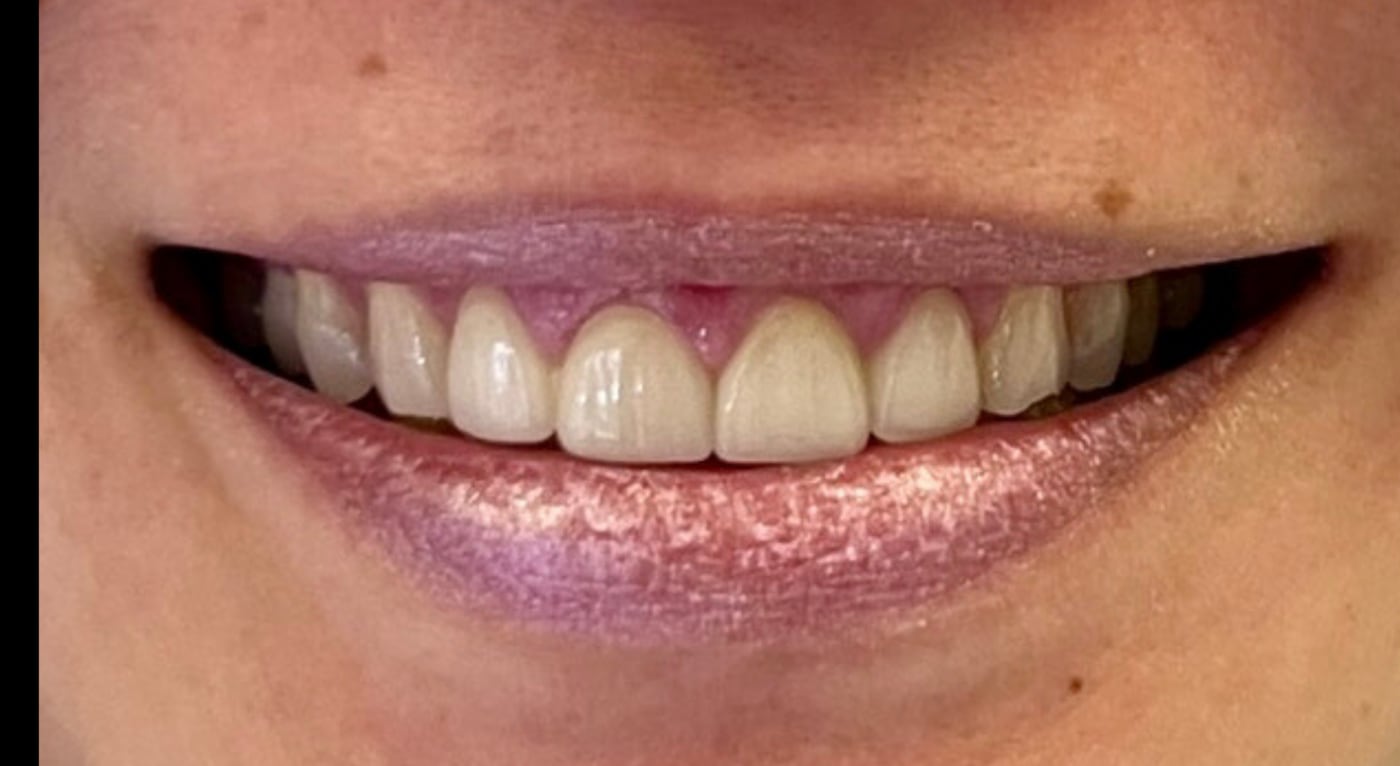 After: even edges, and a colour nobody reads as new work, by Dr. Peter Bonifatto, Las Vegas
