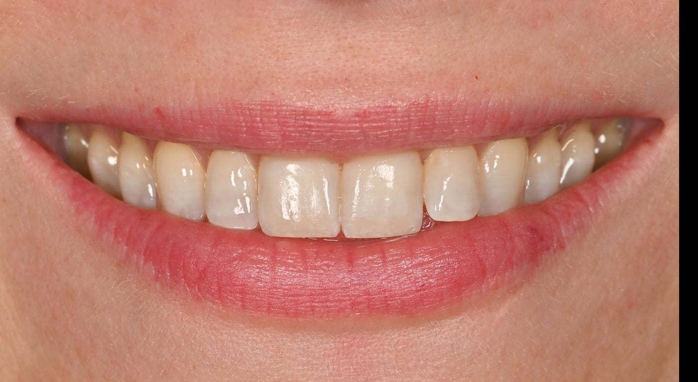 Before: colour was the only thing wrong, and the shape was already right